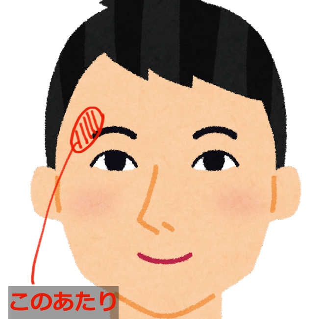 外傷無し ちくちく _ 外傷のない皮膚の痛み 治し方 – 外傷(ガイショウ)とは？ 意味や使い方 – LCPJ